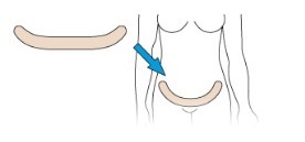 PENSO SILICONE SCARBAN ELASTIC ABDOMINAL